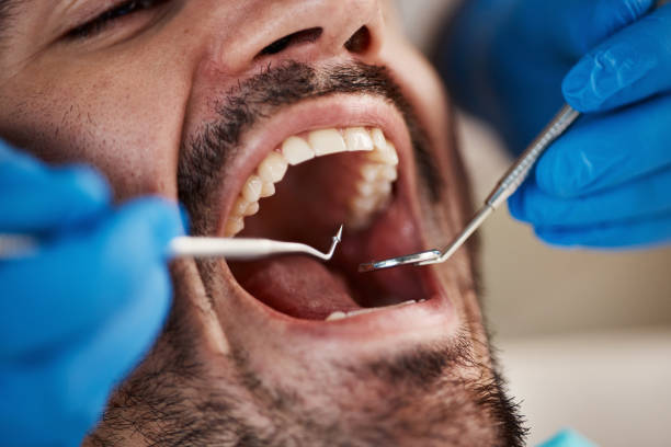 Best Emergency Dental Care for Trauma or Injury in St Anthony, MN